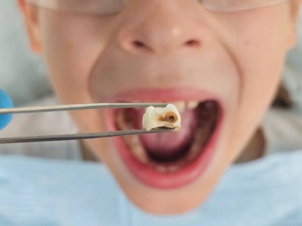 Best Weekend Emergency Dentist in Middleburg, FL